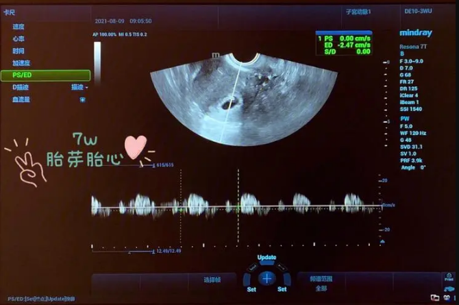 怀孕7周每分钟胎心率120左右