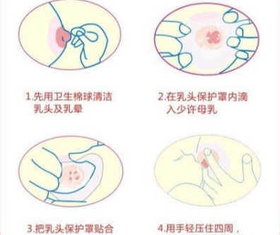 使用乳盾需要注意清洁