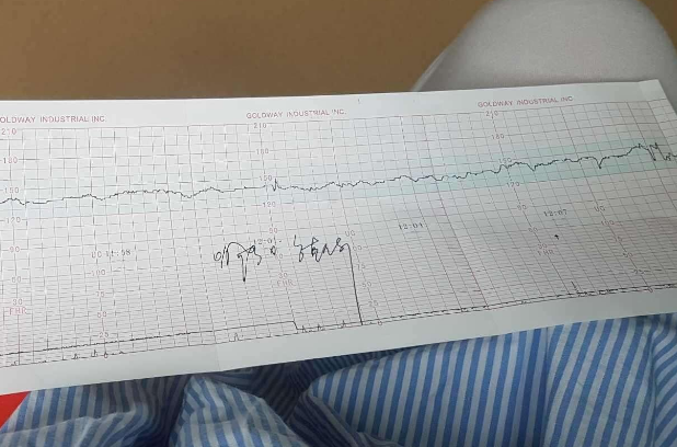 胎心监护报警可能是胎心异常