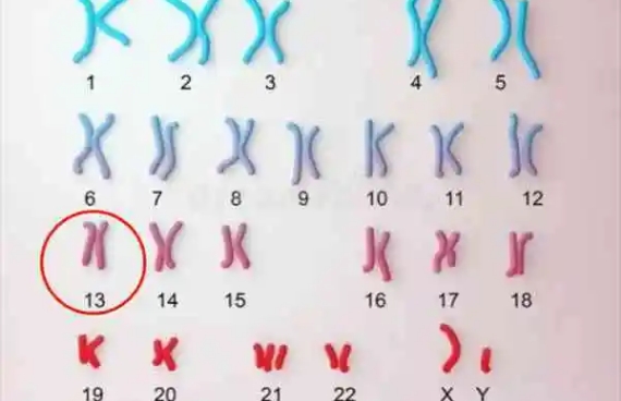 13号染色体数目异常能做哪几代试管？