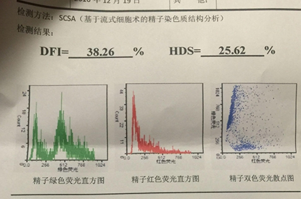 hds和df两项指标都重要