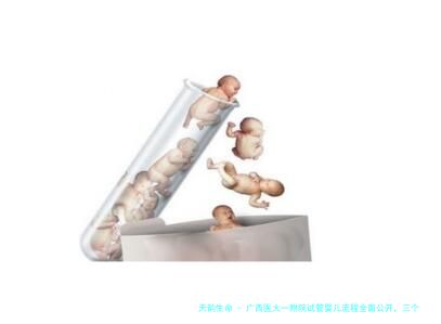 广西医大一附院试管婴儿流程全面公开，三个阶段需要2个月
