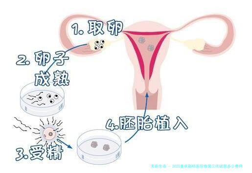 2025重庆新桥医院做第三代试管多少费用？贵吗？