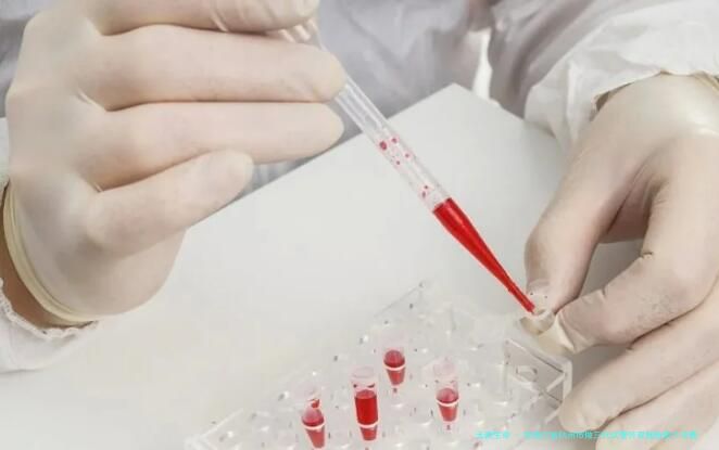 在浙江省杭州市做三代试管怀双胞胎最少花费多少？