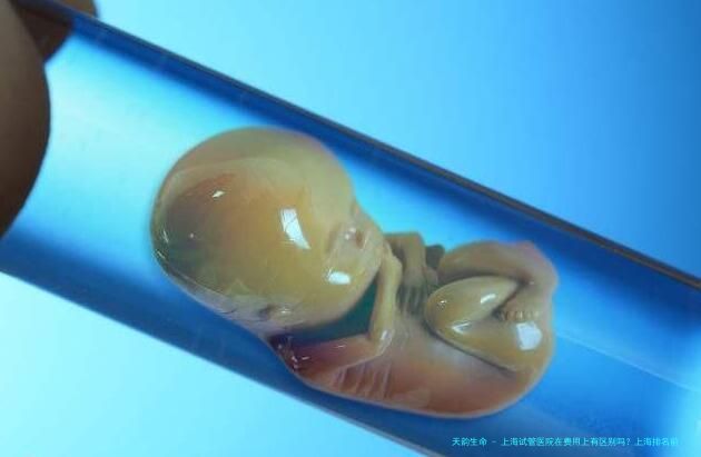 上海试管医院在费用上有区别吗？上海排名前十的试管医院推荐