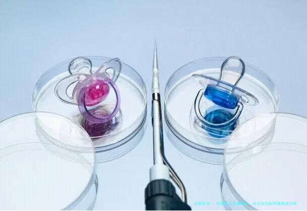 试管婴儿步骤解析，长沙夫妇如何提高成功率？