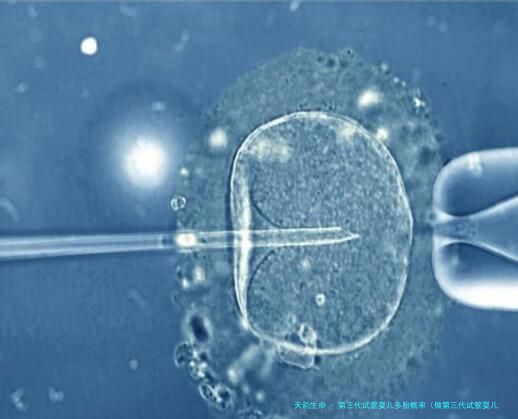 第三代试管婴儿多胎概率（做第三代试管婴儿能做多胎吗）