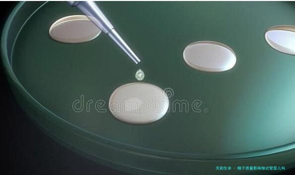 精子质量影响做试管婴儿吗