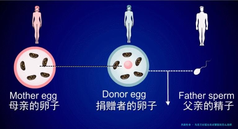 乌克兰比较出名试管医院怎么选择