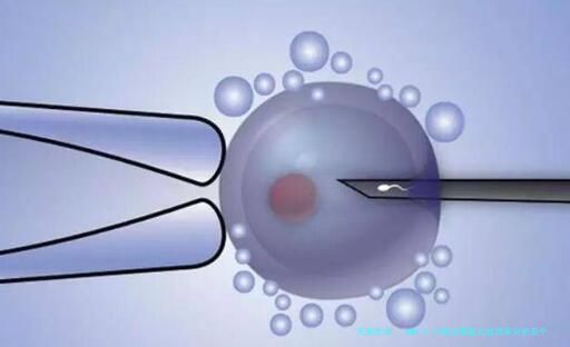 AMH 0.27做试管婴儿成功率分析及个体化方案希望