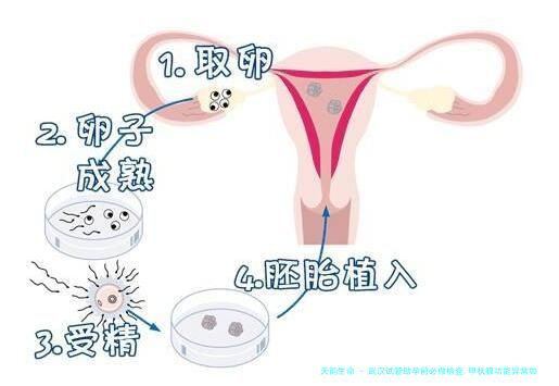 武汉试管助孕前必做检查,甲状腺功能异常如何调理备孕？