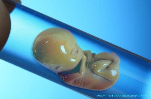 山东省济南妇女儿童医院试管助孕婴儿费用详解