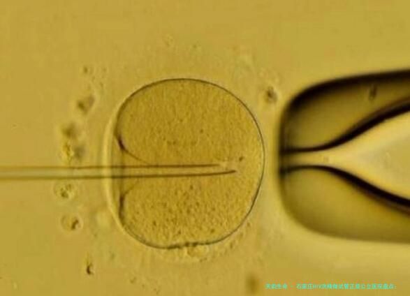 石家庄HIV洗精做试管正规公立医院盘点：流程、费用及三家重点医院详情解析