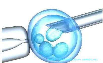 云南3代试管婴儿成功率！云南哪里可以做三代试管！