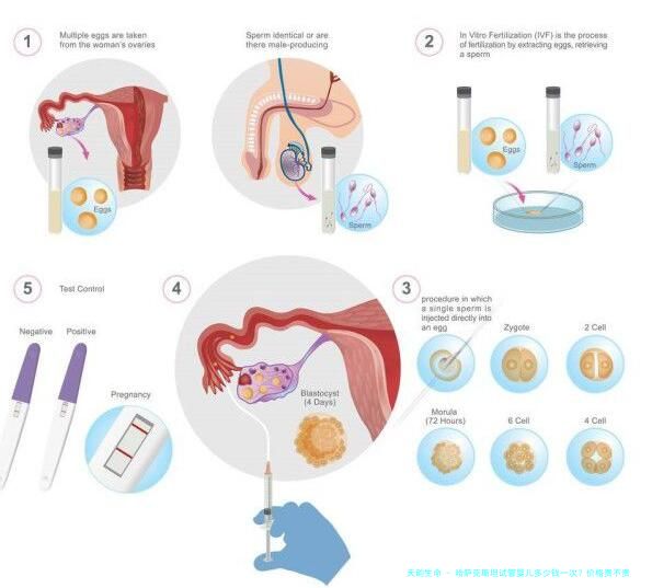 哈萨克斯坦试管婴儿多少钱一次？价格贵不贵？