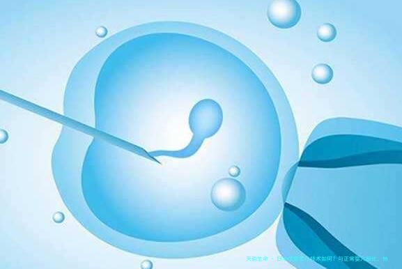 日本试管婴儿技术如何？与正常婴儿相比，他们的健康状况有差异吗？