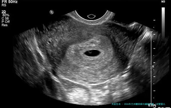 2026年兰州糖尿病与辅助生殖（试管婴儿）实力协同治疗医院推荐指南