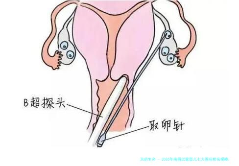 2026年南昌试管婴儿七大医院排名揭晓,试管备孕日记!