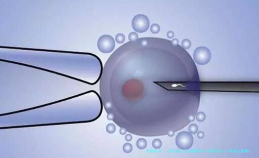 四川做三代试管助孕一般花多少？附单次周期具体花费明细！