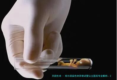 哈尔滨染色体异常试管公立医院专业解析：2026年本地生殖中心优势对比与操作指南