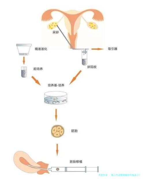 做三代试管移植的价格多少？