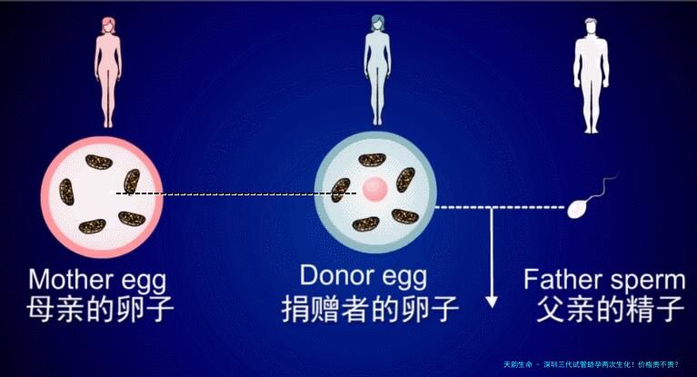 深圳三代试管助孕两次生化！价格贵不贵？