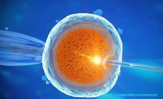 子宫肌瘤患试管助孕技术取得突破性进展