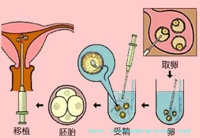 体外受精和试管婴儿哪个成功率高？一文说清真相