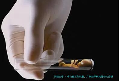 中山做三代试管，广州助孕机构性价比分析