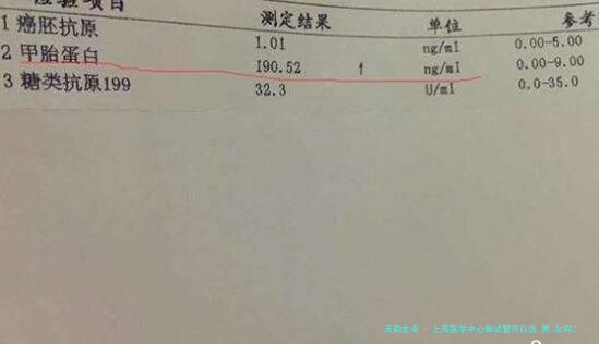 上海医学中心做试管可以选.男.女吗？