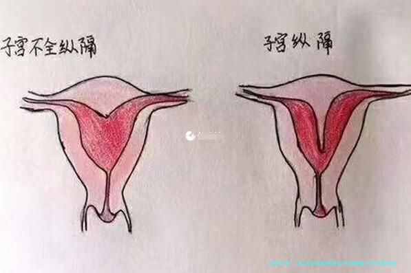 2026年美国单身女性试管婴儿手术的价格分析