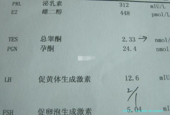 漳州试管婴儿哪个医院最好？