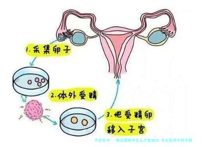 做试管助孕怎么才能成功,专业医师手把手教你提升试管助孕成功率