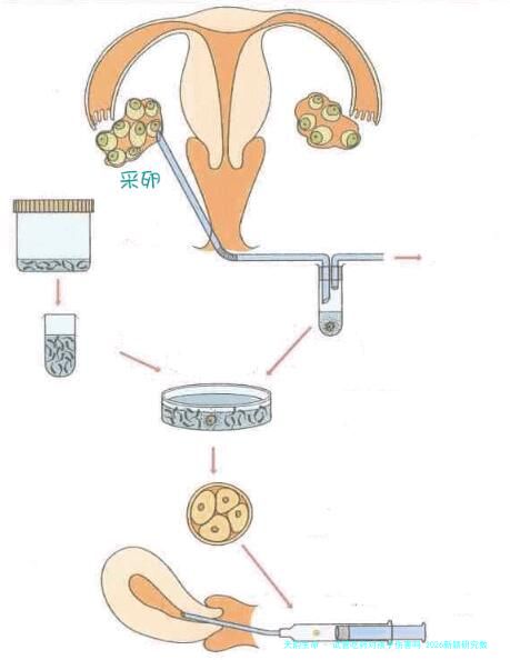 试管吃药对孩子伤害吗 2026新颖研究数据一次性说清