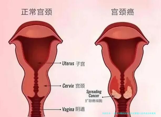 武汉市哪家医院三代试管婴儿技术成功率更高？