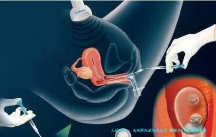 西南医院试管怎么选 我靠这5个判断维度做的决定