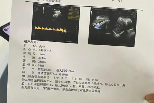 孕24周sd值应该在4.0±1.8之间