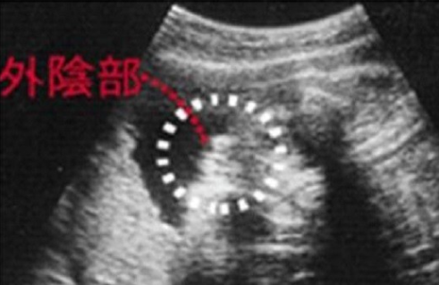 胎儿的七个月时期各项发育已经逐渐完成