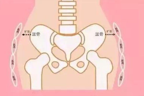 盆骨宽的人生产时不会很痛