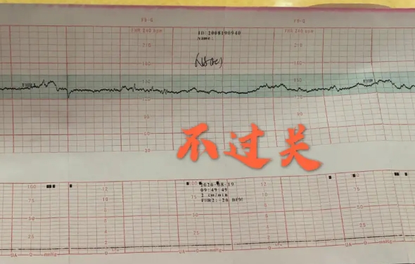 胎心不合格会导致胎儿弱智