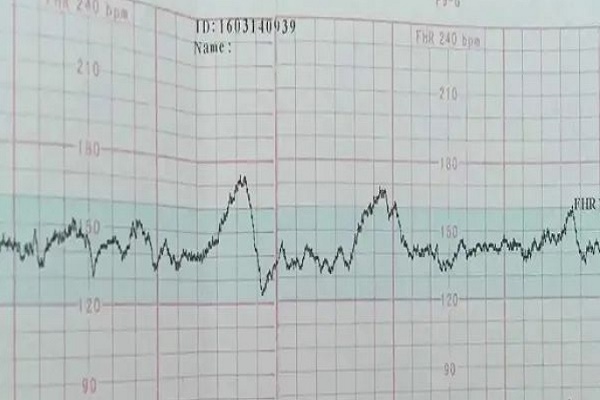 不同孕周的胎心率不一样