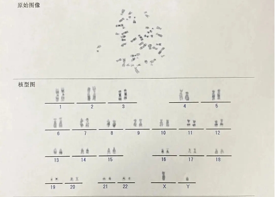 查染色体可以知道xy精子数量