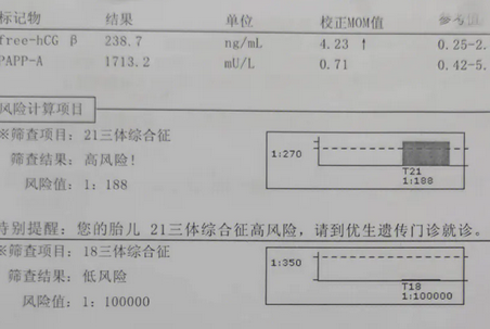 孕妈的唐氏是高风险