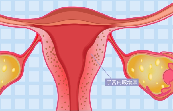 移植后子宫内膜还会有所增厚吗？