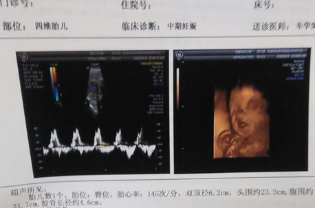 彩超单需要遵循法律法规