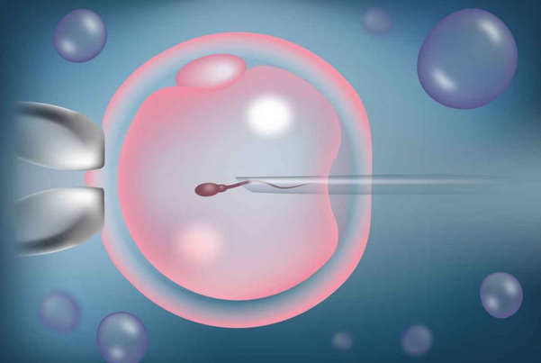 高龄人工授精真实感受,掌握了这8个方法才能提高成功率