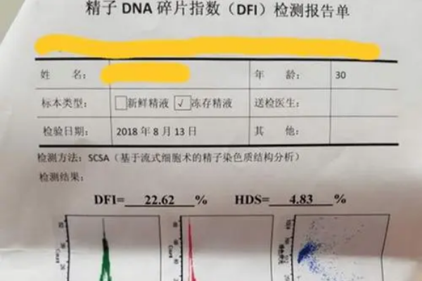 男人的dfi为多少才可以做二代试管手术呢？