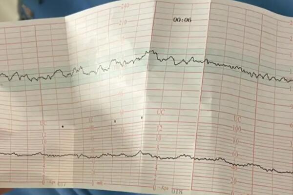 胎心三次不合格要住院观察