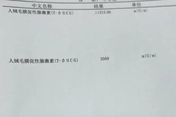 移植14天HCG200IU/L以上为双胎