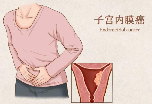 得了子宫内膜癌还能做试管怀孕生孩子吗？